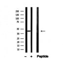 Western blot analysis of FRA1 in lysates of HT29, using FRA1 Antibody(AF4710).