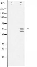 AF3338 staining HeLa by IF/ICC. The sample were fixed with PFA and permeabilized in 0.1% Triton X-100,then blocked in 10% serum for 45 minutes at 25¡ãC. The primary antibody was diluted at 1/200 and incubated with the sample for 1 hour at 37¡ãC. An  Alexa Fluor 594 conjugated goat anti-rabbit IgG (H+L) Ab, diluted at 1/600, was used as the secondary antibod