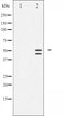 AF3338 staining HeLa by IF/ICC. The sample were fixed with PFA and permeabilized in 0.1% Triton X-100,then blocked in 10% serum for 45 minutes at 25¡ãC. The primary antibody was diluted at 1/200 and incubated with the sample for 1 hour at 37¡ãC. An  Alexa Fluor 594 conjugated goat anti-rabbit IgG (H+L) Ab, diluted at 1/600, was used as the secondary antibod
