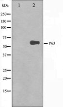Western blot analysis on HeLa cell lysate using p63 Antibody. The lane on the left is treated with the antigen-specific peptide.