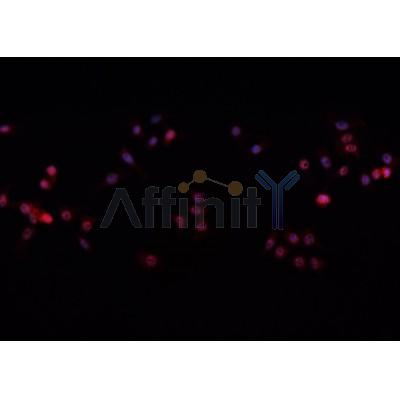 AF0233 staining A-431 cells by IF/ICC. The sample were fixed with PFA and permeabilized in 0.1% Triton X-100,then blocked in 10% serum for 45 minutes at 25¡ãC. The primary antibody was diluted at 1/200 and incubated with the sample for 1 hour at 37¡ãC. An  Alexa Fluor 594 conjugated goat anti-rabbit IgG (H+L) antibody(Cat.