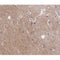AF0091 at 1/200 staining human brain tissue sections by IHC-P. The tissue was formaldehyde fixed and a heat mediated antigen retrieval step in citrate buffer was performed. The tissue was then blocked and incubated with the antibody for 1.5 hours at 22¡ãC. An HRP conjugated goat anti-rabbit antibody was used as the secondary