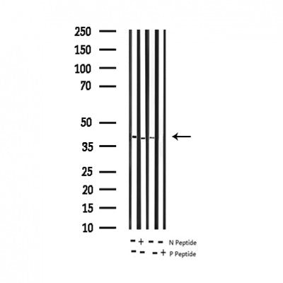 AF3339 staining Hela by IF/ICC. The sample were fixed with PFA and permeabilized in 0.1% Triton X-100,then blocked in 10% serum for 45 minutes at 25¡ãC. The primary antibody was diluted at 1/200 and incubated with the sample for 1 hour at 37¡ãC. An  Alexa Fluor 594 conjugated goat anti-rabbit IgG (H+L) Ab, diluted at 1/600, was used as the secondary antibod