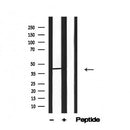 Western blot analysis of TTF-1 in lysates of H441, using TTF-1 Antibody(AF4733).