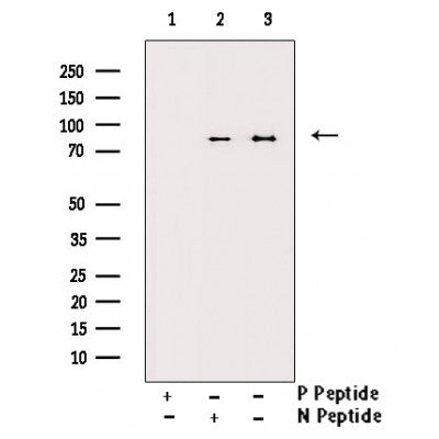 AF3341 staining HepG2 by IF/ICC. The sample were fixed with PFA and permeabilized in 0.1% Triton X-100,then blocked in 10% serum for 45 minutes at 25¡ãC. The primary antibody was diluted at 1/200 and incubated with the sample for 1 hour at 37¡ãC. An  Alexa Fluor 594 conjugated goat anti-rabbit IgG (H+L) Ab, diluted at 1/600, was used as the secondary antibod