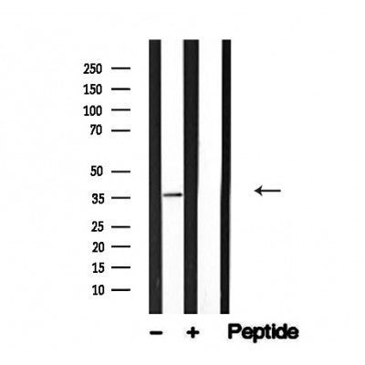 Western blot analysis of PP2A in lysates of HeLa?, using PP2A Antibody(AF4753).