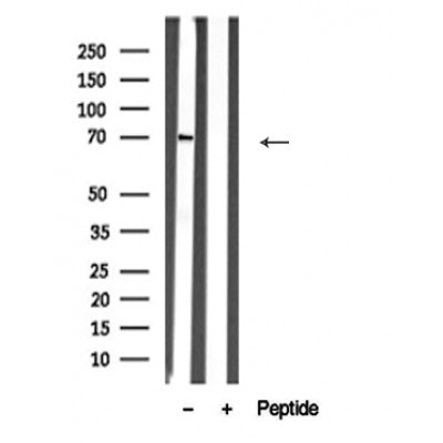 Western blot analysis of PAK1 /PAK2 in lysates of MCF-7, using PAK1 /PAK2 Antibody(AF4763).