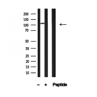 Western blot analysis of PLD1 in lysates of HepG2?, using PLD1 Antibody(AF4765).