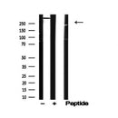 Western blot analysis of ATR in lysates of HeLa?, using ATR Antibody(AF4767).