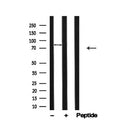Western blot analysis of GIT2 in lysates of HepG2, using GIT2 Antibody(AF4772).