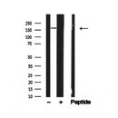 Western blot analysis of HER4/ErbB4 in lysates of T-47D?, using HER4/ErbB4 Antibody(AF4775).