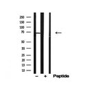 Western blot analysis of CaMKK2 in lysates of Rat brain, using CaMKK2 Antibody(AF4787).