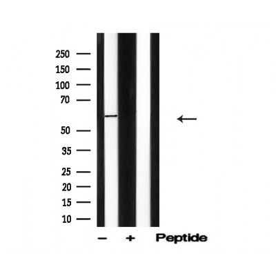 Western blot analysis of PINK1 in lysates of Jurkat?, using PINK1 Antibody(AF4791).