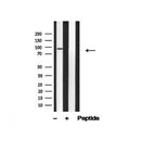 Western blot analysis of CDCP1 in lysates of COLO205, using CDCP1 Antibody(AF4792).