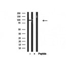 Western blot analysis of CDCP1 in lysates of COLO205, using CDCP1 Antibody(AF4794).