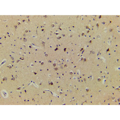 AF3345 staining NIH-3T3 by IF/ICC. The sample were fixed with PFA and permeabilized in 0.1% Triton X-100,then blocked in 10% serum for 45 minutes at 25¡ãC. The primary antibody was diluted at 1/200 and incubated with the sample for 1 hour at 37¡ãC. An  Alexa Fluor 594 conjugated goat anti-rabbit IgG (H+L) Ab, diluted at 1/600, was used as the secondary antibod