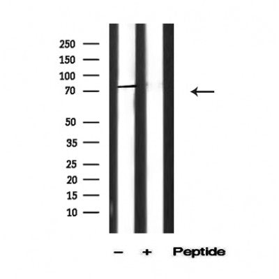 Western blot analysis of Rabphilin 3A in lysates of HeLa TNF alpha 20ng/ml, 2mins, using Rabphilin 3A Antibody(AF4805).