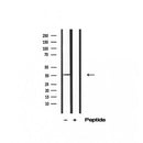 Western blot analysis of extracts from Hela treated with TNF-a, using IkappaB-beta Antibody.