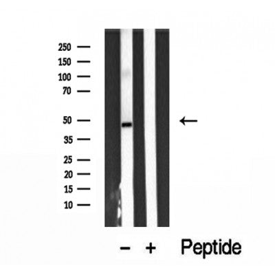 Western blot analysis of extracts from 3t3, using ARL13B Antibody. Lane 1 was treated with the blocking peptide.