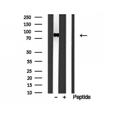 Western blot analysis of extracts from HepG2, using IFT88 antibody. Lane 1 was treated with the blocking peptide.