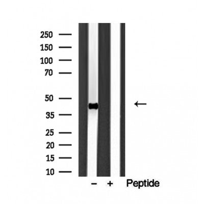 Western blot analysis of extracts from Mouse muscle, using HLAE Antibody. The lane on the left was treated with blocking peptide.