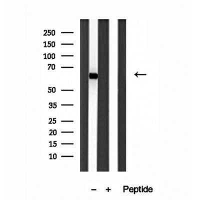 DF12003 at 1/100 staining Rat liver tissue by IHC-P. The sample was formaldehyde fixed and a heat mediated antigen retrieval step in citrate buffer was performed. The sample was then blocked and incubated with the antibody for 1.5 hours at 22¡ãC. An HRP conjugated goat anti-rabbit antibody was used as the secondary