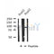 Western blot analysis of extracts of HepG2 cells, using CPT1A antibody.