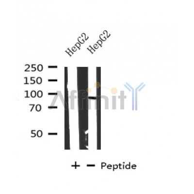 Western blot analysis of extracts of HepG2 cells, using CPT1A antibody.
