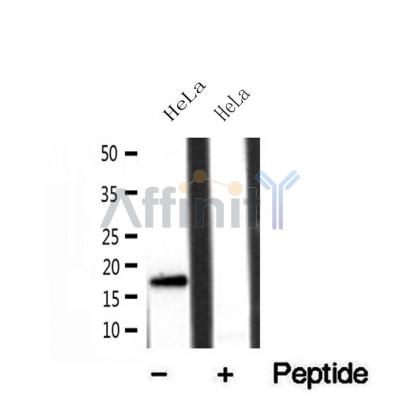 DF12005 at 1/100 staining Mouse kidney tissue by IHC-P. The sample was formaldehyde fixed and a heat mediated antigen retrieval step in citrate buffer was performed. The sample was then blocked and incubated with the antibody for 1.5 hours at 22¡ãC. An HRP conjugated goat anti-rabbit antibody was used as the secondary