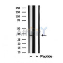 DF12006 staining Hela by IF/ICC. The sample were fixed with PFA and permeabilized in 0.1% Triton X-100,then blocked in 10% serum for 45 minutes at 25¡ãC. The primary antibody was diluted at 1/200 and incubated with the sample for 1 hour at 37¡ãC. An  Alexa Fluor 594 conjugated goat anti-rabbit IgG (H+L) Ab, diluted at 1/600, was used as the secondary antibod