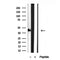 Western blot analysis of extracts from Mouse brain, using SHARPIN Antibody. Lane 1 was treated with the blocking peptide.