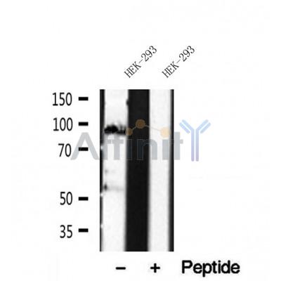 DF12008 at 1/100 staining Mouse liver tissue by IHC-P. The sample was formaldehyde fixed and a heat mediated antigen retrieval step in citrate buffer was performed. The sample was then blocked and incubated with the antibody for 1.5 hours at 22¡ãC. An HRP conjugated goat anti-rabbit antibody was used as the secondary