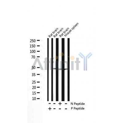AF3348 staining HeLa by IF/ICC. The sample were fixed with PFA and permeabilized in 0.1% Triton X-100,then blocked in 10% serum for 45 minutes at 25¡ãC. The primary antibody was diluted at 1/200 and incubated with the sample for 1 hour at 37¡ãC. An  Alexa Fluor 594 conjugated goat anti-rabbit IgG (H+L) Ab, diluted at 1/600, was used as the secondary antibod