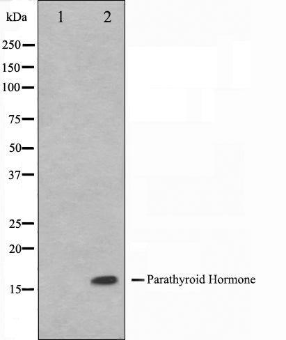 Western blot analysis on A549 cell lysate using Parathyroid Hormone Antibody. The lane on the left is treated with the antigen-specific peptide.