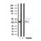 Western blot analysis of extracts from various samples, using STOML2 Antibody.
 Lane 1: Hela treated with blocking peptide.
 Lane 2: Hela;
 Lane 3: 293.