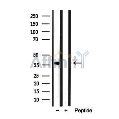 Western blot analysis of extracts from various samples, using STOML2 Antibody.
 Lane 1: Hela treated with blocking peptide.
 Lane 2: Hela;
 Lane 3: 293.