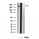 Western blot analysis of extracts from various samples, using CNOT1 Antibody.
 Lane 1: 3T3-L1 treated with blocking peptide.
 Lane 2: 3T3-L1;
 Lane 3: HepG2;
 