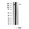 Western blot analysis of extracts from various samples, using CNOT1 Antibody.
 Lane 1: 3T3-L1 treated with blocking peptide.
 Lane 2: 3T3-L1;
 Lane 3: HepG2;
 