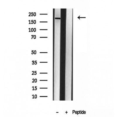 Western blot analysis of extracts from various samples, using CNOT1 Antibody.
 Lane 1: 3T3-L1 treated with blocking peptide.
 Lane 2: 3T3-L1;
 Lane 3: HepG2;
 