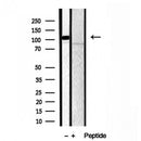 DF12012 staining HepG2 by IF/ICC. The sample were fixed with PFA and permeabilized in 0.1% Triton X-100,then blocked in 10% serum for 45 minutes at 25¡ãC. The primary antibody was diluted at 1/200 and incubated with the sample for 1 hour at 37¡ãC. An  Alexa Fluor 594 conjugated goat anti-rabbit IgG (H+L) Ab, diluted at 1/600, was used as the secondary antibod