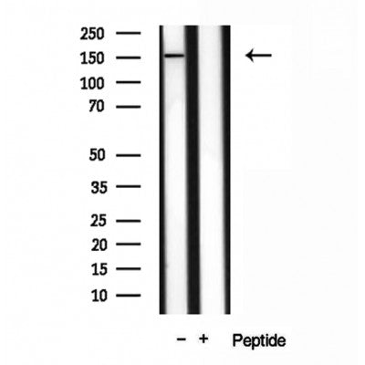 DF12013 staining HepG2 by IF/ICC. The sample were fixed with PFA and permeabilized in 0.1% Triton X-100,then blocked in 10% serum for 45 minutes at 25¡ãC. The primary antibody was diluted at 1/200 and incubated with the sample for 1 hour at 37¡ãC. An  Alexa Fluor 594 conjugated goat anti-rabbit IgG (H+L) Ab, diluted at 1/600, was used as the secondary antibod