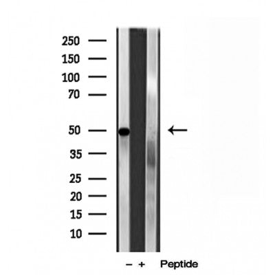 DF12015 at 1/100 staining Mouse spleen tissue by IHC-P. The sample was formaldehyde fixed and a heat mediated antigen retrieval step in citrate buffer was performed. The sample was then blocked and incubated with the antibody for 1.5 hours at 22¡ãC. An HRP conjugated goat anti-rabbit antibody was used as the secondary