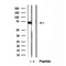 Western blot analysis of extracts from Mouse  liver, using ADAM12 Antibody. The lane on the left was treated with blocking peptide.