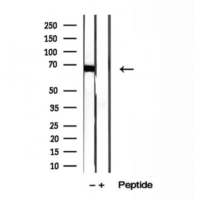 Western blot analysis of extracts from Mouse  liver, using ADAM12 Antibody. The lane on the left was treated with blocking peptide.
