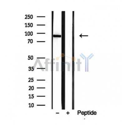 Western blot analysis of extracts from Hela, using PLOD2-Specific Antibody. Lane 1 was treated with the blocking peptide.