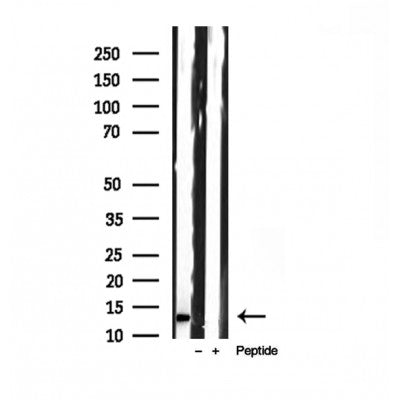 Western blot analysis of extracts from Mouse lung, using Phospholemman Antibody. The lane on the left was treated with blocking peptide.