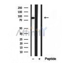 DF12024 staining HepG2 by IF/ICC. The sample were fixed with PFA and permeabilized in 0.1% Triton X-100,then blocked in 10% serum for 45 minutes at 25¡ãC. The primary antibody was diluted at 1/200 and incubated with the sample for 1 hour at 37¡ãC. An  Alexa Fluor 594 conjugated goat anti-rabbit IgG (H+L) Ab, diluted at 1/600, was used as the secondary antibod