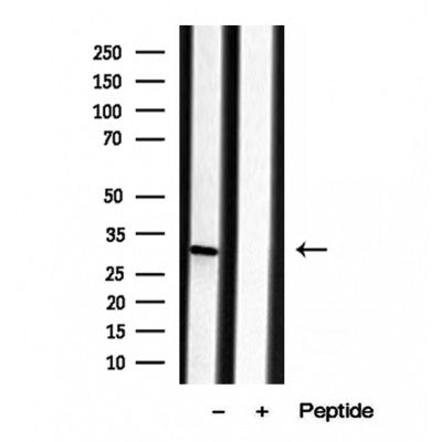 Western blot analysis of extracts from 293, using ECHS1 Antibody. Lane 1 was treated with the blocking peptide.