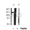 DF12026 at 1/100 staining Mouse kidney tissue by IHC-P. The sample was formaldehyde fixed and a heat mediated antigen retrieval step in citrate buffer was performed. The sample was then blocked and incubated with the antibody for 1.5 hours at 22¡ãC. An HRP conjugated goat anti-rabbit antibody was used as the secondary