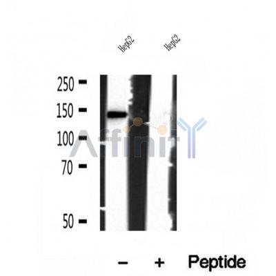 DF12026 at 1/100 staining Mouse kidney tissue by IHC-P. The sample was formaldehyde fixed and a heat mediated antigen retrieval step in citrate buffer was performed. The sample was then blocked and incubated with the antibody for 1.5 hours at 22¡ãC. An HRP conjugated goat anti-rabbit antibody was used as the secondary